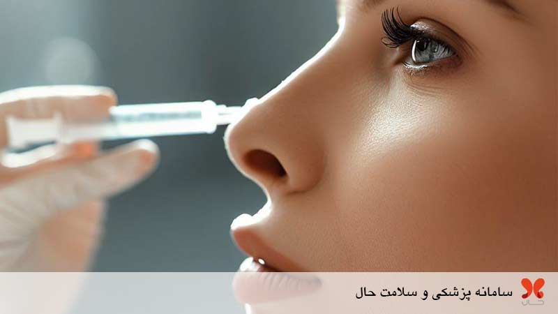 فیلر بینی برای چه کسانی مناسب است