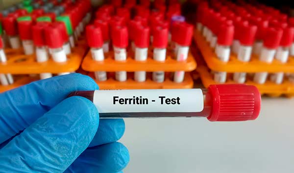 تست ferritin