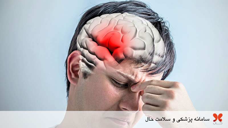 آنوریسم مغزی