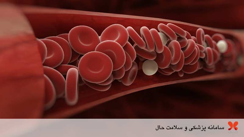 پلی سیتمی ورا چیست