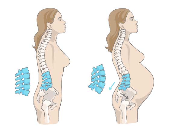 درد گودی کمر در بارداری