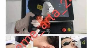 کلینیک لیزر،خانم آرتا