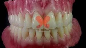 دندانسازی طاهادنت