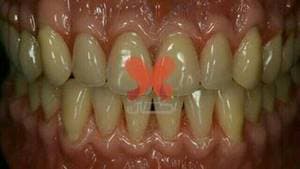 دندانسازی دندان مصنوعی لابراتوار دندان سازی تضمینی