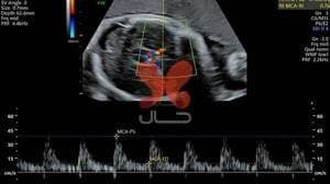 بیمارستان و زایشگاه کسری