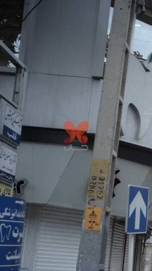 آندوسکوپی گوارش قلب