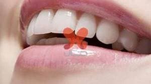 لابراتور پروتز دندان