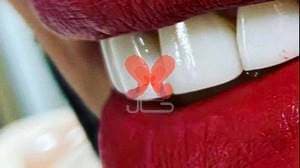 درمانگاه دندانپزشکی دکتر حاتمی