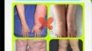 مرکز ترمیم و درمان زخم کرمانشاه دکتر کیوان سلطانی