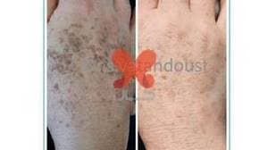 دکتر سمانه وطن دوست متخصص پوست، مو و زیبایی